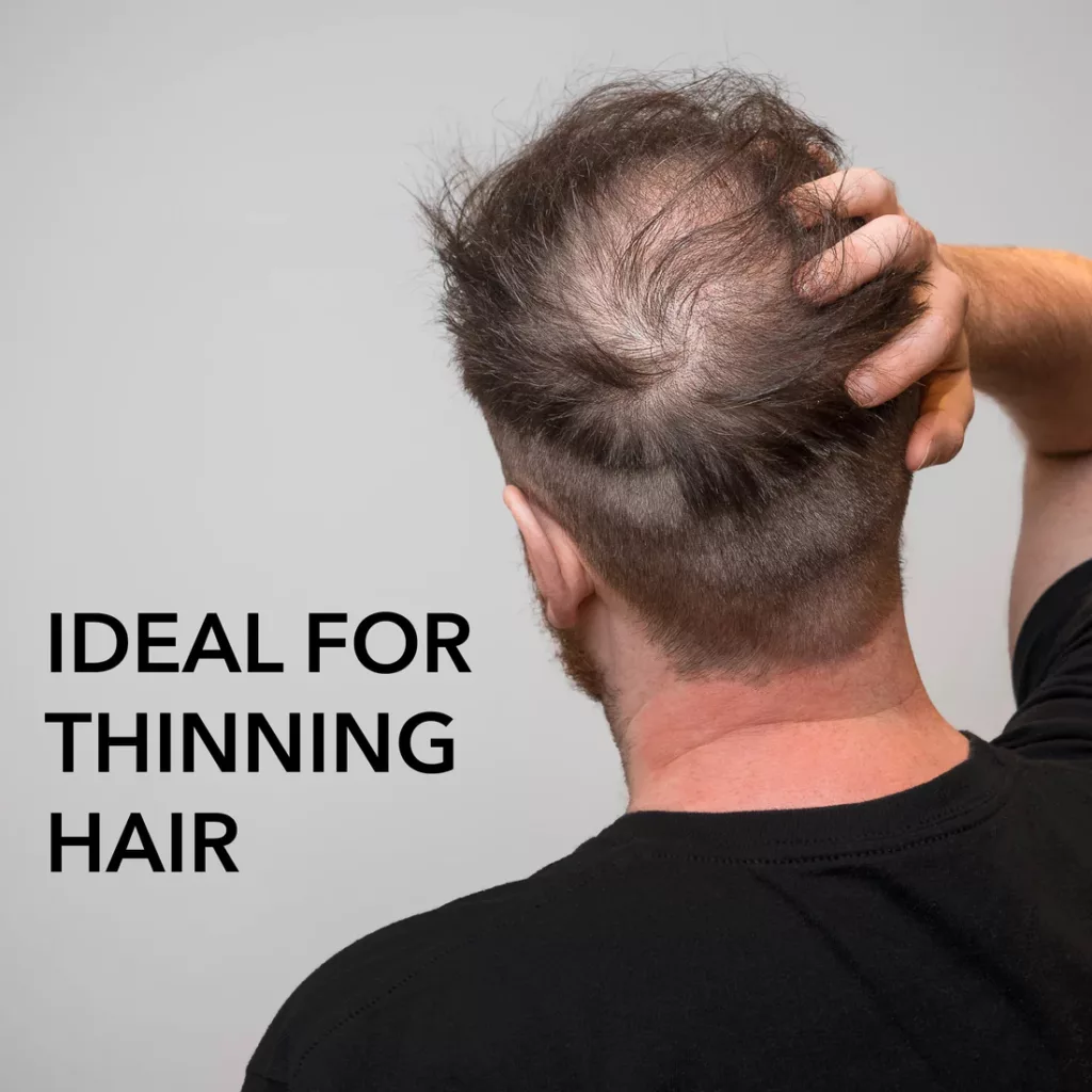 ماساژور برقی سر کد 003-QC