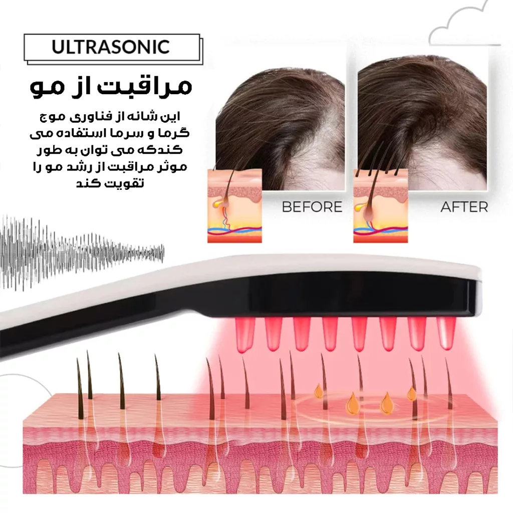 ماساژور برقی سر کد 003-QC