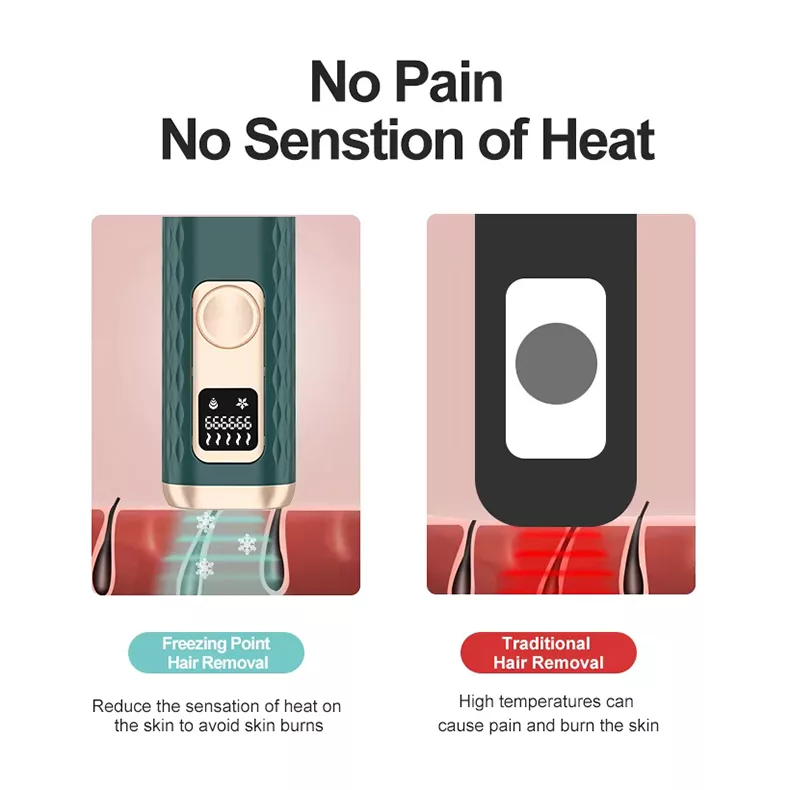 لیزر موهای زائد بدن اینزا مدل W-1095B