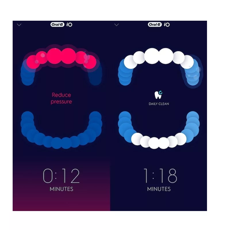 مسواک برقی اورال-بی مدل GENIUS X 20000 ANTHRACTIVE