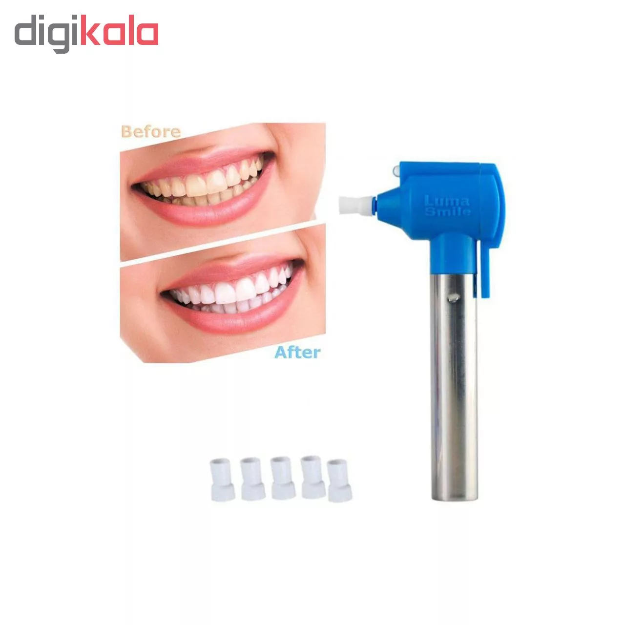 جرم گیر ، لمینت و بلیچینگ دندان لوما اسمایل مدل original2018