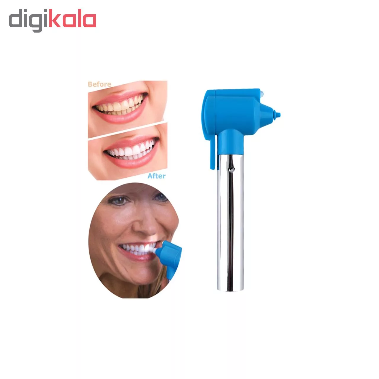 جرم گیر ، لمینت و بلیچینگ دندان لوما اسمایل مدل original2018